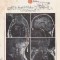 American Family Physician, February 1987