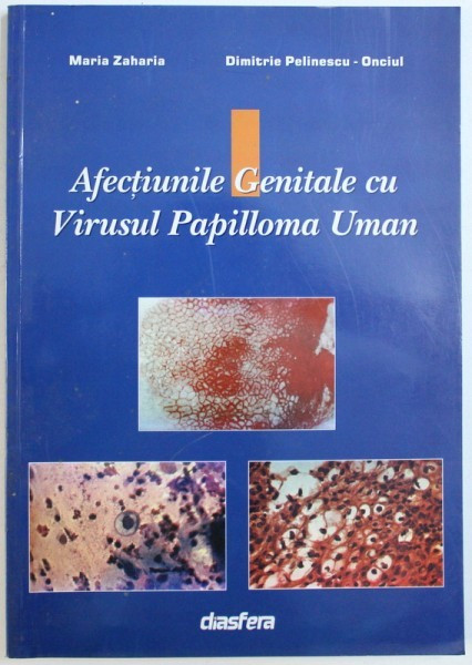 AFECTIUNILE GENITALE CU VIRUSUL PAPILLOMA UMAN de MARIA ZAHARIA si DIMITRIE PELINESCU-ONCIUL , 2002