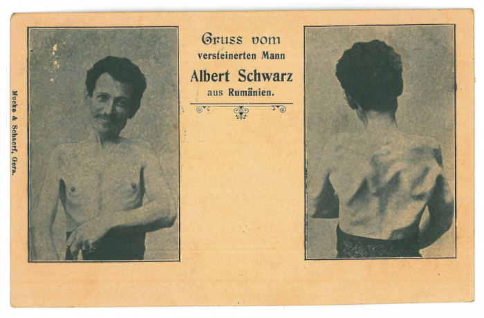 3331 - The Petrified Man ALBERT SCHWARZ, Romania - old postcard - unused