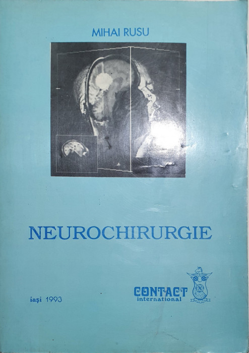 NEUROCHIRURGIE-MIHAI RUSU