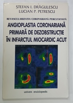 REVASCULARIZATIA CORONARIANA PERCUTATNATA : ANGIOPLASTIA CORONARIANA PRIMARA DE DEZOBSTRUCTIE IN INFARCTUL MIOCARDIC ACUT de STEFAN I. DRAGULESCU foto