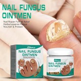 South Moon* 2 Buc.Crema pentru ciuperca unghiilor, elimina ciuperca, reparator