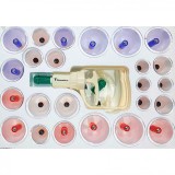 Set 24 ventuze de masaj terapeutic cu vacuum, magnetoterapie si acupresura