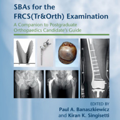 Sbas for the Frcs(tr&orth) Examination: A Companion to Postgraduate Orthopaedics Candidate's Guide
