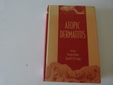 Atopic dermatitis