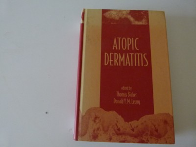 Atopic dermatitis foto