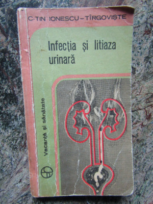 Infectia si litiaza urinara-C-tin Ionescu Tirgoviste foto