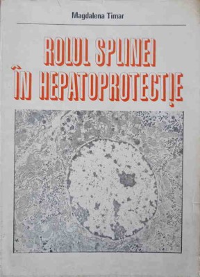 ROLUL SPLINEI IN HEPATOPROTECTIE-MAGDALENA TIMAR-224774 foto