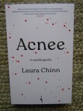 Acnee O autobiografie - Laura Chinn