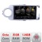 Navigatie Toyota Yaris 2010-2018 5960Pro-YARIS10 Android Octa Core Qualcomm 2K Qled 8+128 DTS DSP 360 4G Optical CarStore Technology