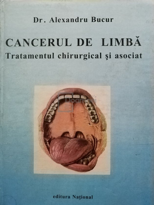 Alexandru Bucur - Cancerul de limba. Tratamentul chirurgical si asociat (editia 1998)