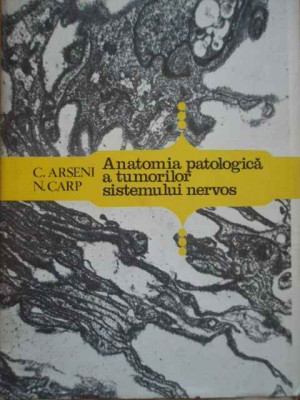 Anatomia Patologica A Tumorilor Sistemului Nervos - C.arseni N.carp ,289382 foto