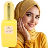 Ser cu turmeric &icirc;mpotriva acneei, Global Fashion, Turmeric Serum Anti-Acne, 50 ml