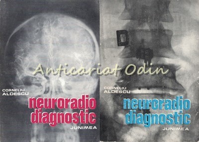 Neuroradiodiagnostic I, II - Corneliu Aldescu foto