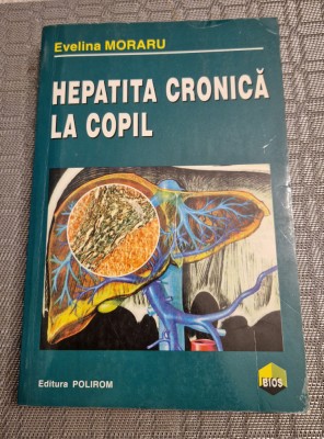 Hepatita cronica la copil Evelina Moraru foto