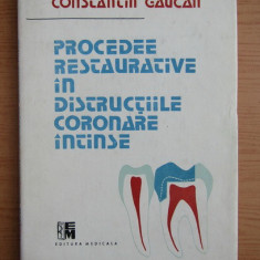 Constantin Gaucan - Procedee restaurative in distructiile coronare intinse