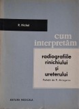 Carte Radiografii Rinichi Ureter Interpretare - R. Hickel
