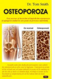 Osteoporoza - Tom Smith