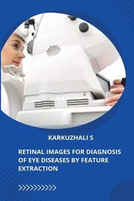 Retinal Images for Diagnosis of Eye Diseases by Feature Extraction foto