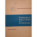 M. S. Miron - Tumorile maligne ale ochiului (Editia: 1967)