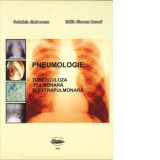 Pneumologie. Tuberculoza pulmonara si extrapulmonara - Gabriela Jimborean, Edith Simona Ianosi
