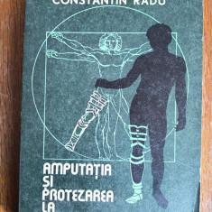 Amputatia si protezarea la membrul inferior - Constantin Radu / R3P2S