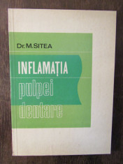 Inflama?ia pulpei dentare-DR.M.Sitea foto