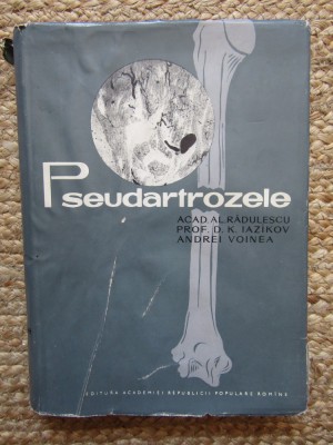 Alexandru Radulescu - Pseudartrozele foto