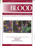 Blood Journal American Society Hematology 1998 Stare Buna Coperta Cartonata Editie Veche Cadou Cititori