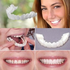 Fatete dentare Snap On Smile solutia ideala pentru un zambet perfect proteza foto