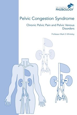 Pelvic Congestion Syndrome - Chronic Pelvic Pain and Pelvic Venous Disorders foto