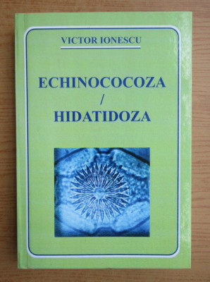 Victor M. Ionescu - Echinococoza. Hidatidoza foto