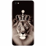 Husa silicon pentru Xiaomi Redmi Note 5A, Lion King