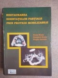Restaurarea edentatiilor partiale prin proteze mobilizabile Dorin Bratu
