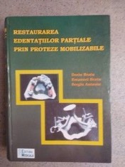 Restaurarea edentatiilor partiale prin proteze mobilizabile Dorin Bratu