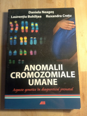 Anomalii cromoziale umane,Daniela neagos foto