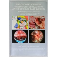 ENDOSCOPIC CADAVER DISSECTION FOR TEACHING ANTERIOR SKULL BASE SURGERY by Prof. PAOLO CASTELNUOVO , 2008