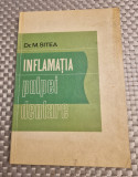 Inflamatia pulpei dentare M. Sitea