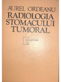 Aurel Ordeanu - Radiologia stomacului tumoral (Editia: 1977)