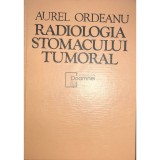 Aurel Ordeanu - Radiologia stomacului tumoral (Editia: 1977)