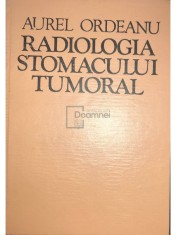 Aurel Ordeanu - Radiologia stomacului tumoral (Editia: 1977) foto