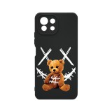 Husa BestCase&reg; Premium Silicon, Compatibila Cu Xiaomi Mi 11 Lite, 1.2MM Slim,