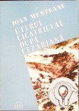 Uterul Cicatriceal Dupa Cezariana - Ioan Munteanu, Ed. Facla 1985, Carte de Chirurgie Ginecologica