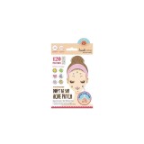 LookATME Don&#039;t Be Shy Acne Patch Plasturi &icirc;mpotriva coșurilor și imperfecțiunilor