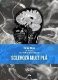 Scleroza multiplă