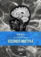 Scleroza multiplă