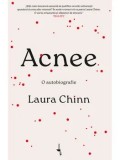 Cumpara ieftin Acnee. O autobiografie/Laura Chinn