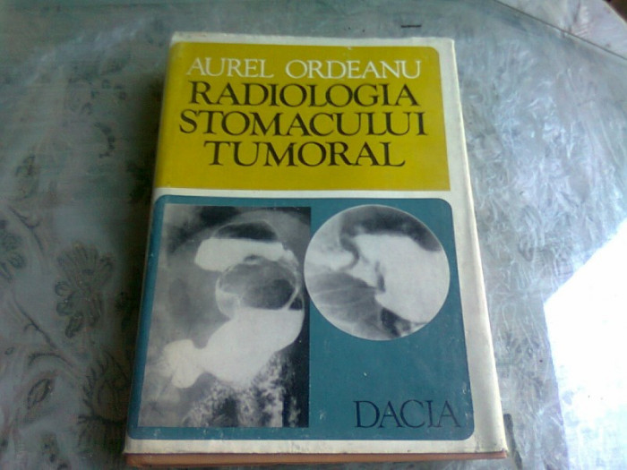 RADIOLOGIA STOMACULUI TUMORAL , AUREL ORDEANU