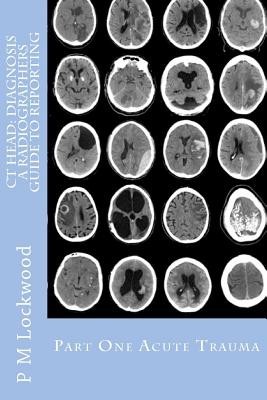 CT Head: Diagnosis a Radiographers Guide to Reporting Part 1 Acute Trauma: Part One Acute Trauma foto