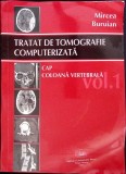 TRATAT DE TOMOGRAFIE COMPUTERIZATA VOL.1 CAP, COLOANA VERTEBRALA-MIRCEA BURUIAN-262407